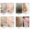 7 in 1 Hydro Dermabrasion Aqua Peel Clean Face Water Oxygen Beauty Skin Care