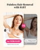 IPL Laser Hair Removal 990000 Flashes Painless Permanent Face Body
