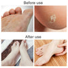 Foot File Hard Dead Skin Callus Remover Rasp Scraper Dead Skin Scrubber Black